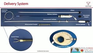 New Transcatheter Tricuspid Valve Replacement System