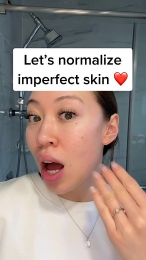 Let’s Normalize Imperfect Skin - Skincare Tips