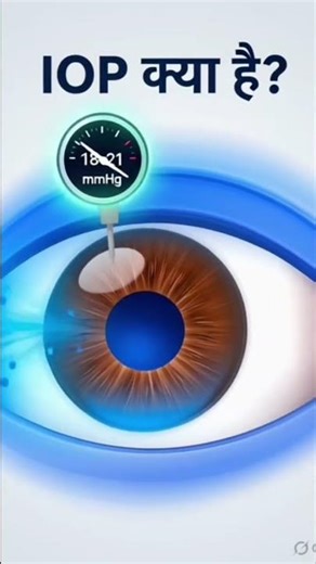 IOP क्या है 👀👀#viralvideo #motivation #trending #eyeiop #eyetest #vlogger #hostellife #keratometry
