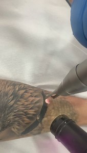 133 reactions · 28 comments | New laser tattoo removal picoSure - CynoSure with fractional laser CO2 and Cryo 6 freezing air !!!From kostas laser cender Limassol and Nicosia tel. 25935279 & 22262750 & 99492913 see results in our website: https://www.kostashair.com/beauty-center | Kostas Laser Center | Facebook