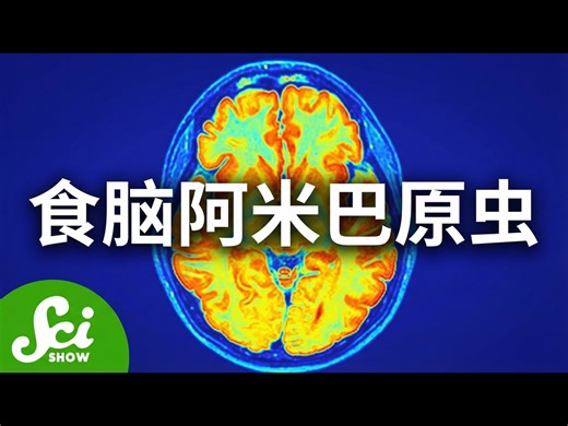 【熟肉】你需要多担心食脑阿米巴原虫？ - SciShow