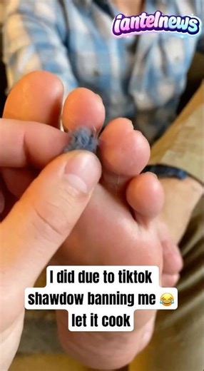 I Regret Posting This Toe Video