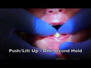 Post - Procedure Stretches for a Tongue Tie Release