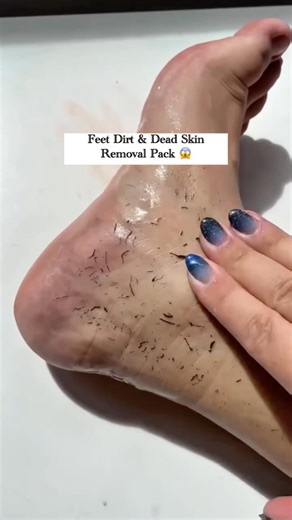 Feet Dirt & Dead skin removal pack. Feet whitening pack. #shorts #viral #ytshorts