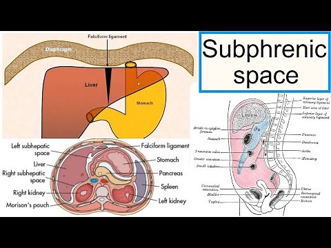 subphrenic space