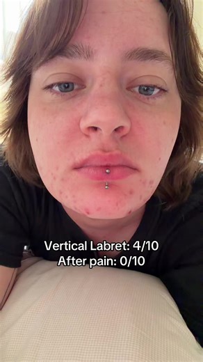 Vertical Labret Piercing: My Experience and Pain Levels
