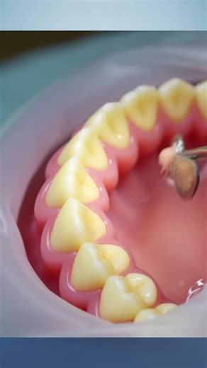 What Really Happens After You Lose a Tooth 😨 | Dental Implant Explained #facts #shorts #tooth loss
