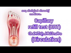 Capillary refill test (CRT) രക്തപ്രവാഹം (Circulation ) ‪@Itsmeeminu‬