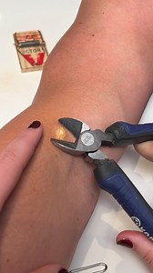 54K views · 249 reactions | How to pop the whole pimple! How to pop the whole pimple! Please be advised that this page’s videos are intended for entertainment purposes only. The videos on this page include scripted dramas, satires, parodies, magic tricks, and other forms of entertainment. Names, characters and incidents are often the product of the director’s imagination, so any resemblance to actual persons or actual events is purely coincidental. | Donald Jenkins | Facebook