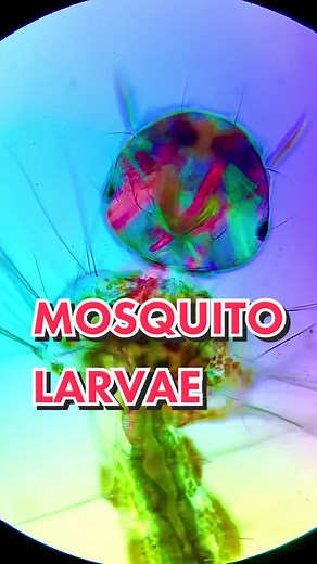 Exploring Mosquito Larvae Under a Microscope