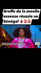GREFFE DE MOELLE OSSEUSE RÉUSSIE AU SÉNÉGAL🚨🩸… C'est une première en #Afriquesubsaharienne francophone. Le #Sénégal a réussi une #greffe de moelle osseuse. Une opération vitale pour les patients souffrants de #CancerDuSang. | Tout sur la médecine