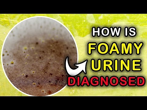 How to IDENTIFY the Cause of FOAM IN URINE : Foamy Urine Diagnosis