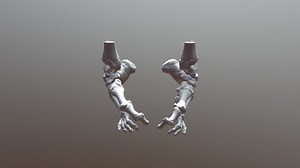 Bilateral Congenital Defect of the Feet - 3D model by NCHS Cardiac Advanced Projects Lab 3D