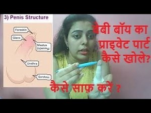 How to Open Baby Boy Private Part | Clean private Part | Care for foreskin | बच्चे का सुसु कैसे खोले