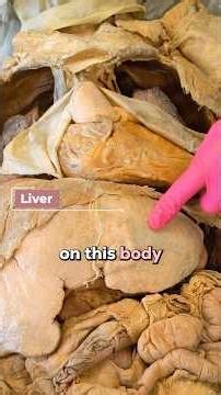 Why Your Body Needs Cholesterol