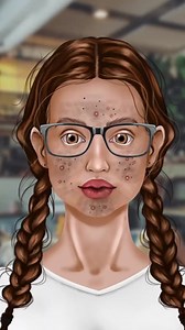 86K views · 337 reactions | Have a nice day #asmr #usa #Care #SkinCare #Treatment #Removal #Transformation #makeup #beauty #asmrecho #satisfying #acne #ASMRSounds #ASMRVidoes #viral #foryou | Beauty Animation | Facebook