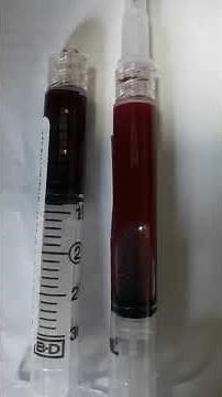 Difference between Arterial blood and venous blood