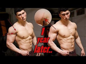 OVER A YEAR AFTER TEARING MY PEC | CURRENT BENCH PROGRESS | LUKE ELSMAN