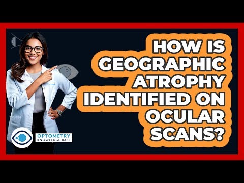 How Is Geographic Atrophy Identified On Ocular Scans? - Optometry Knowledge Base