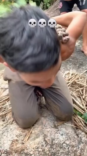 Understanding Trypophobia in Skin: Causes, Symptoms, and Solutions