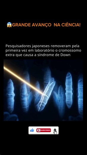 Fim da Síndrome de Down? #universo #astronomia #ciência #shorts