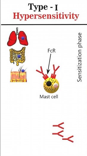 Type I Hypersensitivity Reaction #animation #csirnetgate