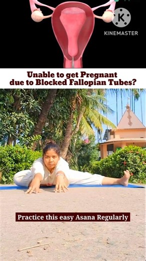Unblock Fallopian Tubes Naturally: Boost Fertility with Yoga & Clear the Path to Parenthood 🌸💖