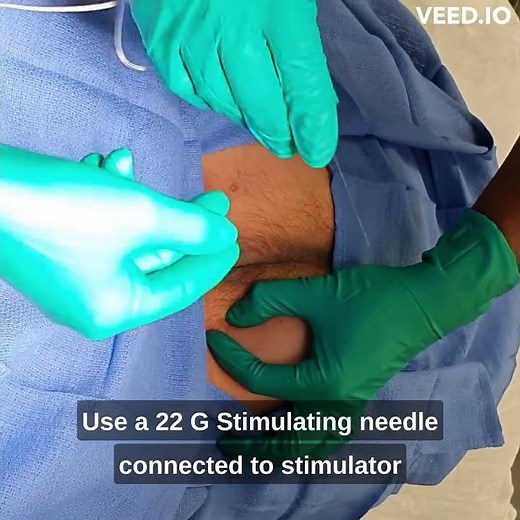 Pudendal Nerve Block