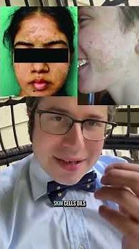 What is the caveman method? What is dermatosis neglecta? #skincare #caveman #doctor