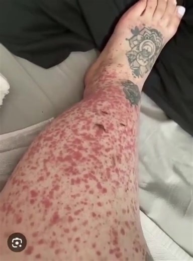 397K views · 441 reactions | These are the consequences of sleeping with the…See more | Mind Space | Facebook