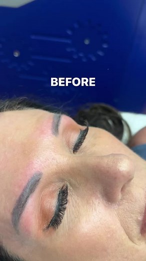 Cosmetic ink removes fast in some cases instantly 😱 #fyp #viral #storytime