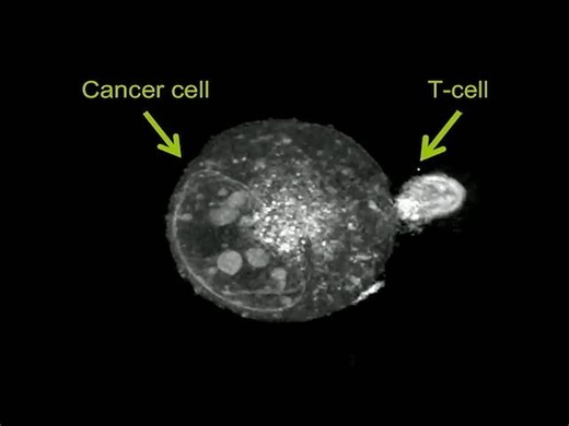 正在试图给癌细胞打孔注入的T细胞