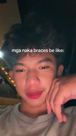 Mga Naka Braces Be Like: Ang Gabay sa Braces Life