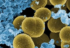 Enfermedades de Staphylococcus aureus
