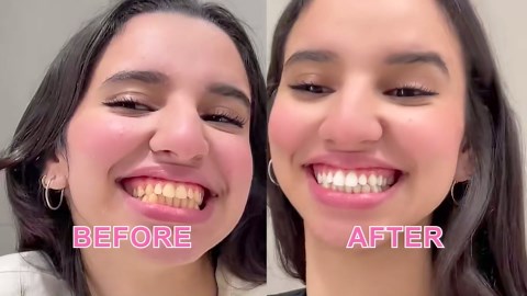 2Pack Niacinamide Whitening Toothpaste - Niacinamide Toothpaste - Help for Fresh Breath & Enamel Safe