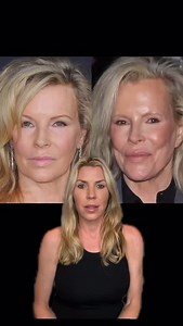 Kim Basinger is a great example of what happens when plastic surgery doesn’t age with you. Starting with non-surgical options can sometimes be way better in the long run! What do you think? | Jennifer Armstrong, MD