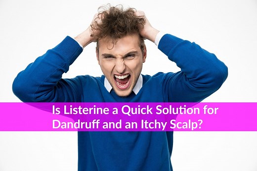 Listerine in Hair: Good for Dandruff and an Itchy Scalp?
