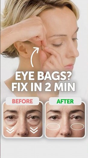 👋 Bye Bye EYE BAGS! 2 Minute FACE EXERCISES! #facelift #eyebags #faceexercise