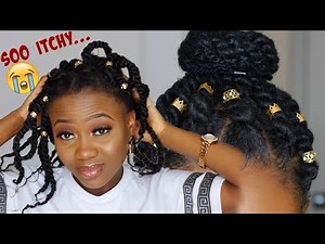 ITCHY SCALP? I Got You! | Quick Fix For Itchy Scalp and BOX BRAIDS, TWIST, Maintenance!