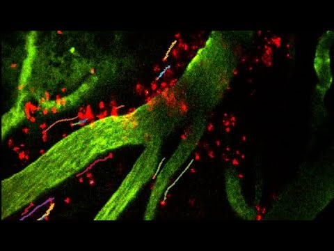 V-061:InVivo Imaging Capture Cerebral Hemorrhage that Alters Cerebrospinal Fluid Flow in Mouse Brain