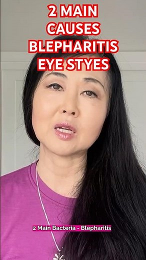 Recurring Eye Stye Why You Keep Getting Them #eyestye #goseechristy