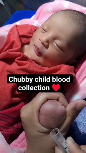 chubby child blood collection ♥️ #babygirl #chubbygirl #nicubaby #trend #shortvideo #nicu #baby