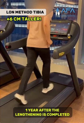 One Year After Limb Lengthening Surgery Results