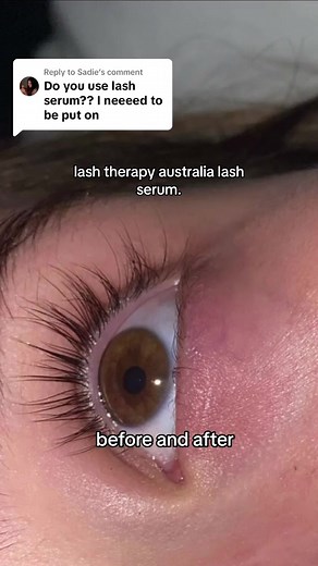Lash Therapy Australia: Natural Lash Serum
