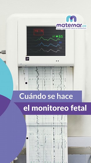 El monitoreo fetal es una prueba que se realiza durante el embarazo para observar los latidos del corazón del bebé y sus movimientos. Esto ayuda a asegurar que esté sano y bien. En Maternar.co, te brindamos la información y el apoyo que necesitas para vivir un embarazo seguro y tranquilo. Visítanos en https://youtu.be/yPNTRGOptpc para obtener más información de este procedimiento y otros temas relacionados con el embarazo. ¡Te esperamos! #MaternarCo | Maternar.co