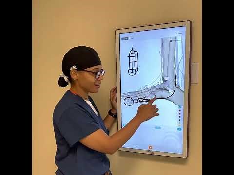 5th Metatarsal Fractures