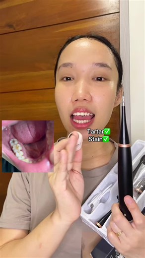 Effective Electric Teeth Cleaner for Stain Removal