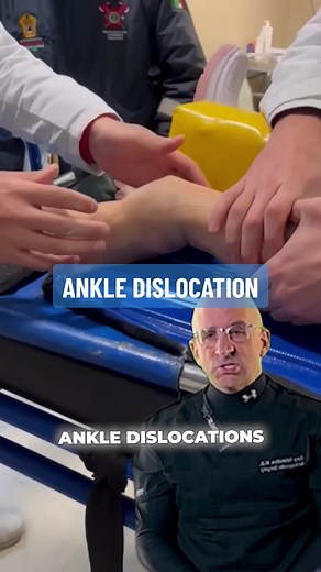 Ankle Dislocation requires fast medical response to help prevent nerve and vessel damage #ankle #anklebreaker #brokenankle