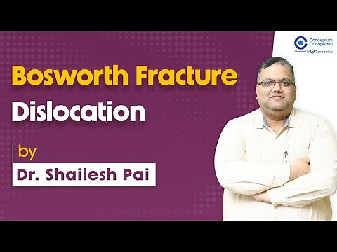 Bosworth Fracture Dislocation by Dr. Shailesh pai | Orthopedic Residency | Conceptual Orthopedic