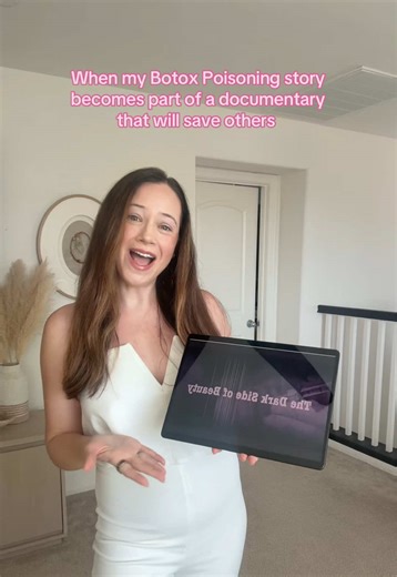 “The Dark Side of Beauty” is available to watch now!! 🎬 The documentary features my Botox injury story, alongside 3 other amazing, powerful women who survived this toxin. It explores our personal journeys, Botox in general, and the broader beauty industry’s growing obsession with youth, and the risks that are often overlooked in the pursuit. Praying for a day where everyone has informed consent about this toxin. 🙏🏻 The film is around 1 hour long. Available to watch on YouTube. #documentary #b